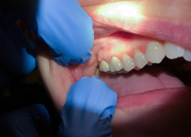 Best Emergency TMJ Treatment in Louisville, OH