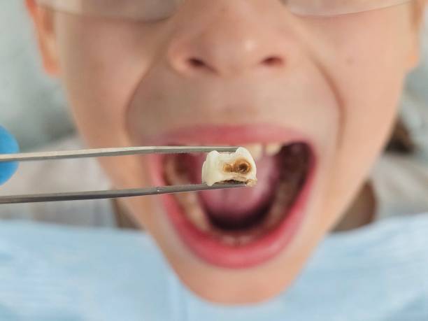 Best Same-Day Emergency Dental Services in Louisville, OH